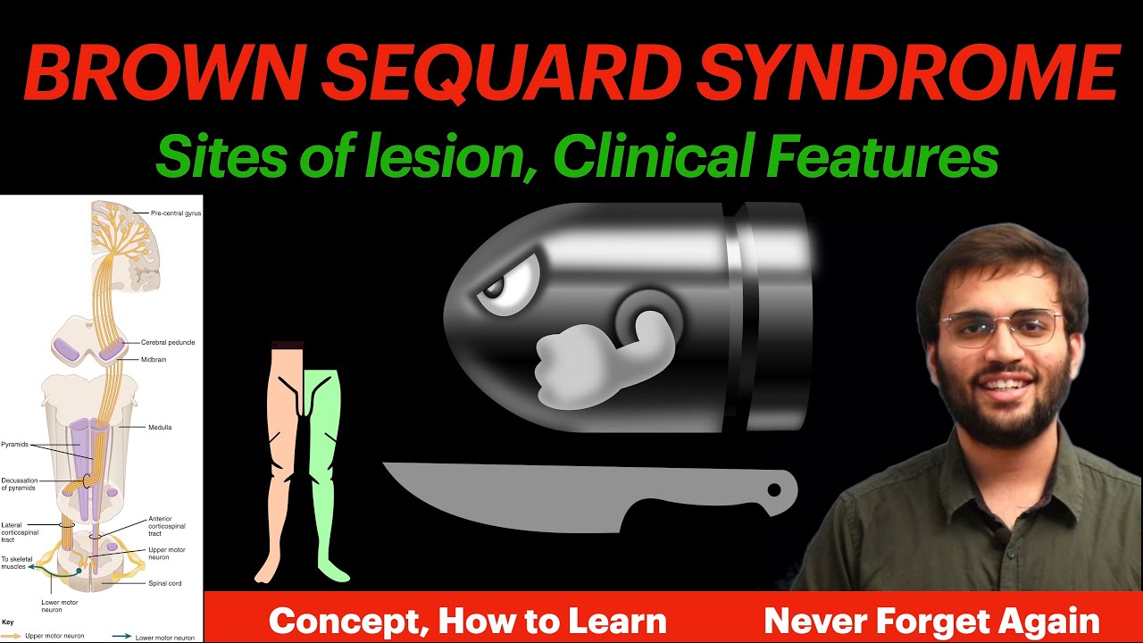 Brown Sequard Syndrome | Physiology | Hemisection of Spinal Cord | CNS Physiology Video