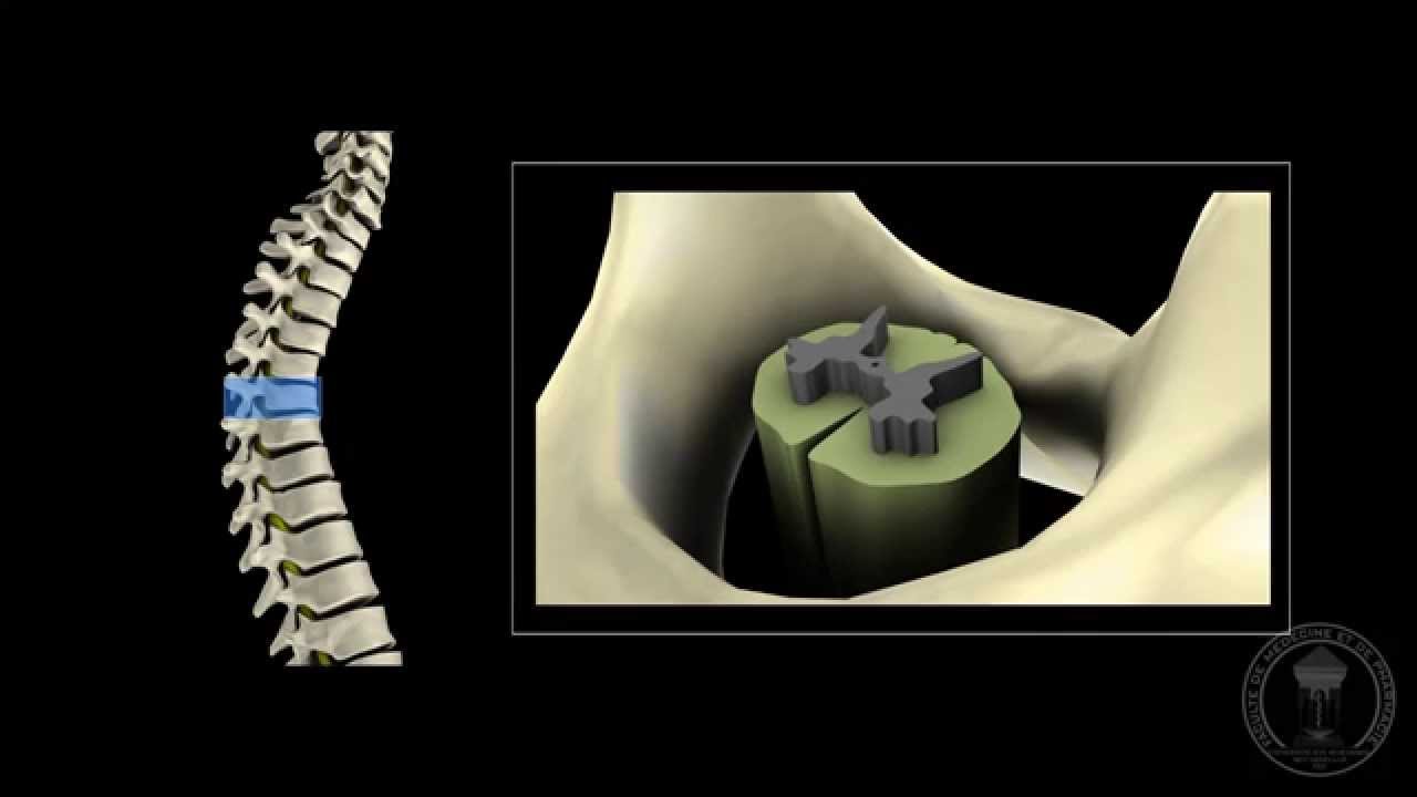 Neuroanatomie - La moelle épinière