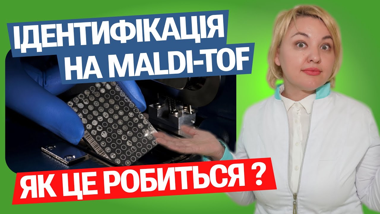 Як відбувається ідентифікація бактерій на MALDI TOF?