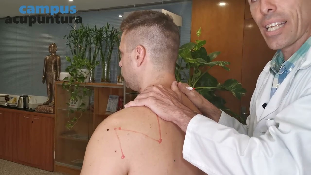 Punto x punto: Meridiano de Intestino Delgado - Prof. Raúl Ucieza | Campus Acupuntura