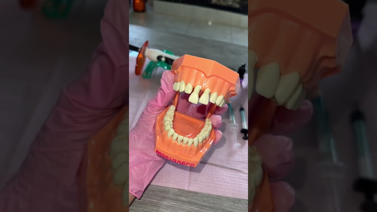 Férula para traumatismo dental
