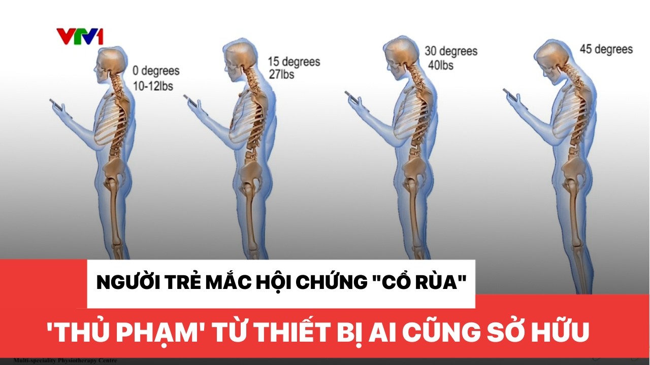 Người trẻ mắc hội chứng 