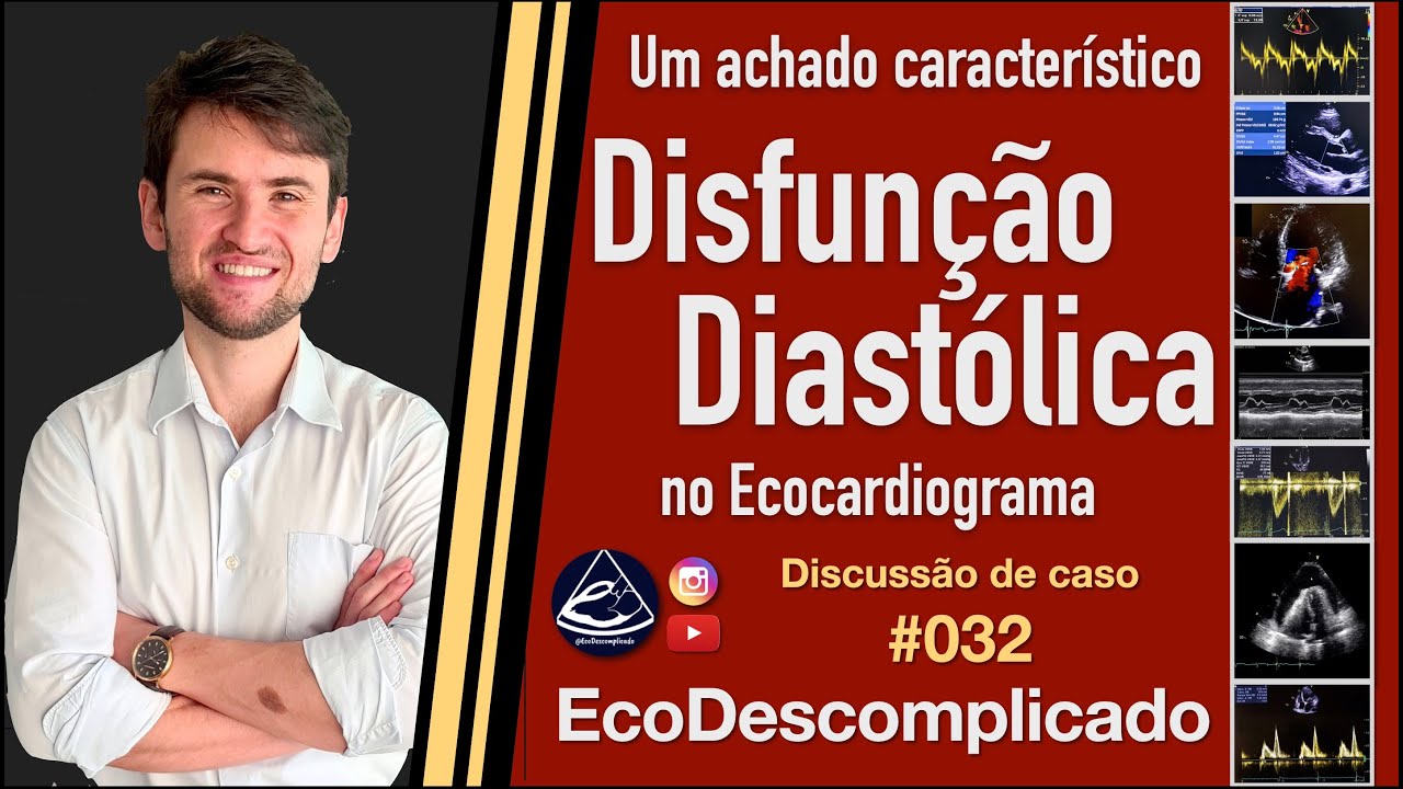 EcoDescomplicado - Discussão de caso AO VIVO #032 - Um achado característico de Disfunção Diastólica