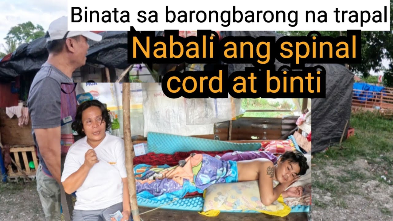 Binata sa barong barong NABALI ang Spinal cord at binti ll Rene OC