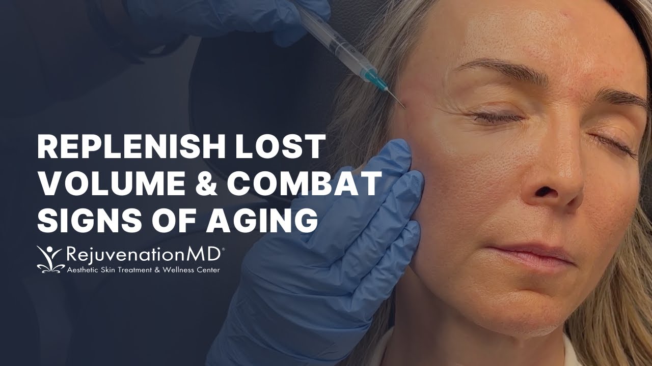 Get A Natural, Non-Surgical Facelift with Sculptra!