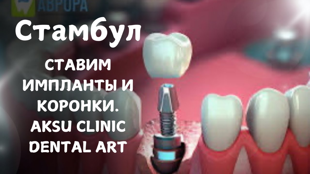 🇹🇷ISTANBUL ‼️ИМПЛАНТЫ И КОРОНКИ. ЛЕТИМ ИЗ АМЕРИКИ ‼️ОБЗОР КЛИНИКИ, ЦЕНЫ. AKSU CLINIC DENTAL ART