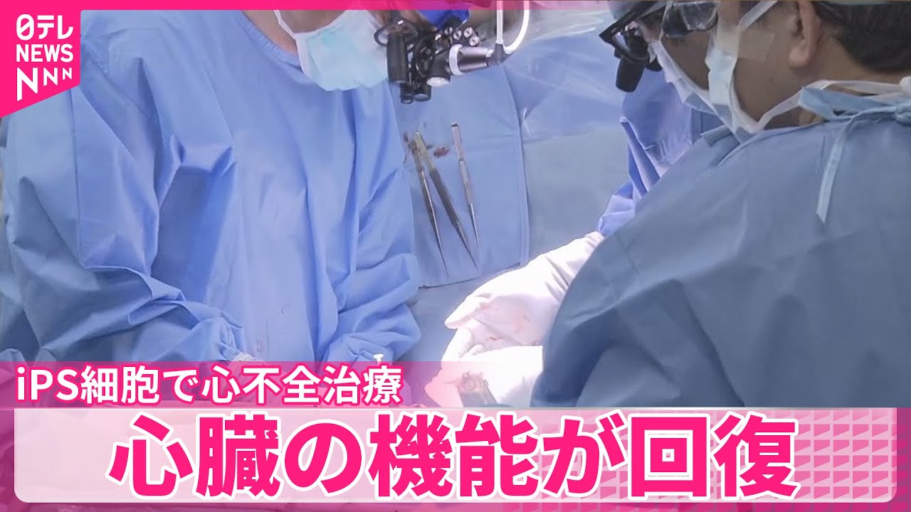 【世界初の治験】iPS細胞で心不全治療  心臓の機能が回復  大きな副作用なし&hellip;