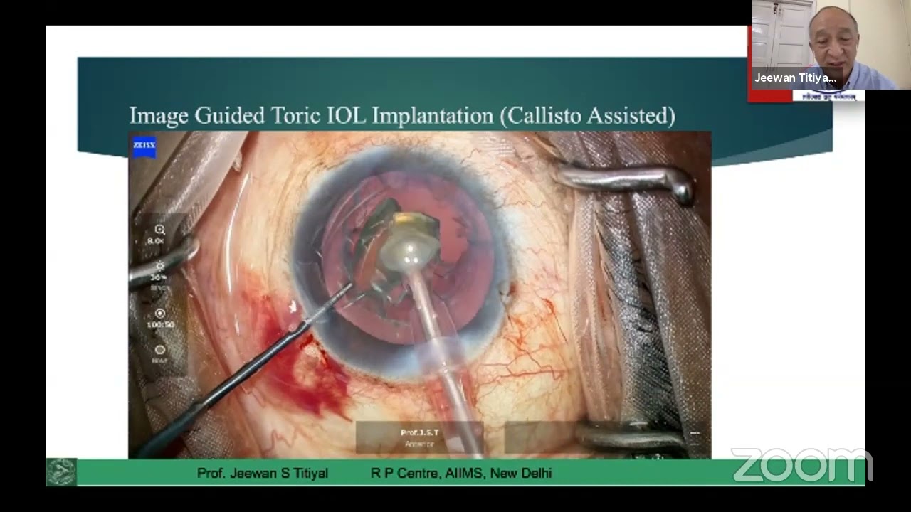 AIOC2021 - GP241 - Dr.J.S.Titiyal