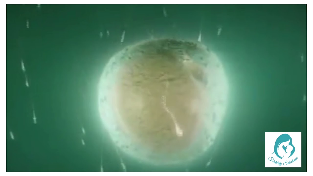 IVF Step by Step Procedure