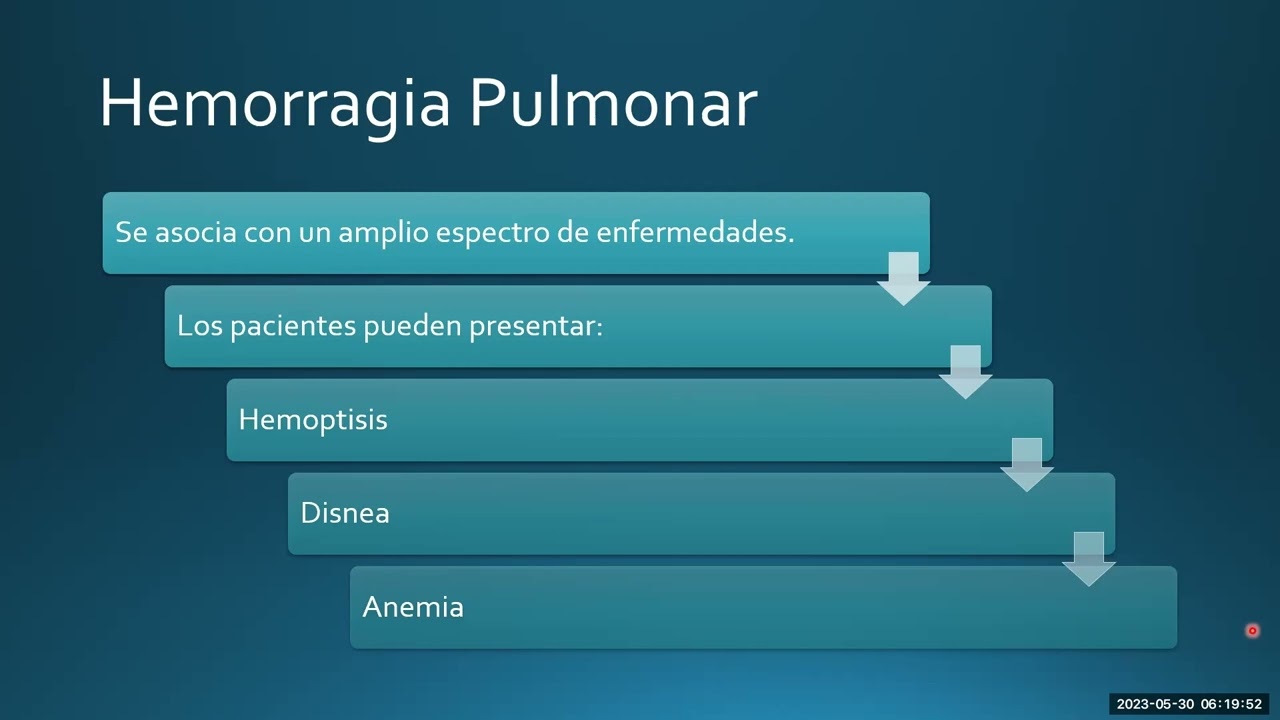 Opacidad en Vidtio Esmerilado