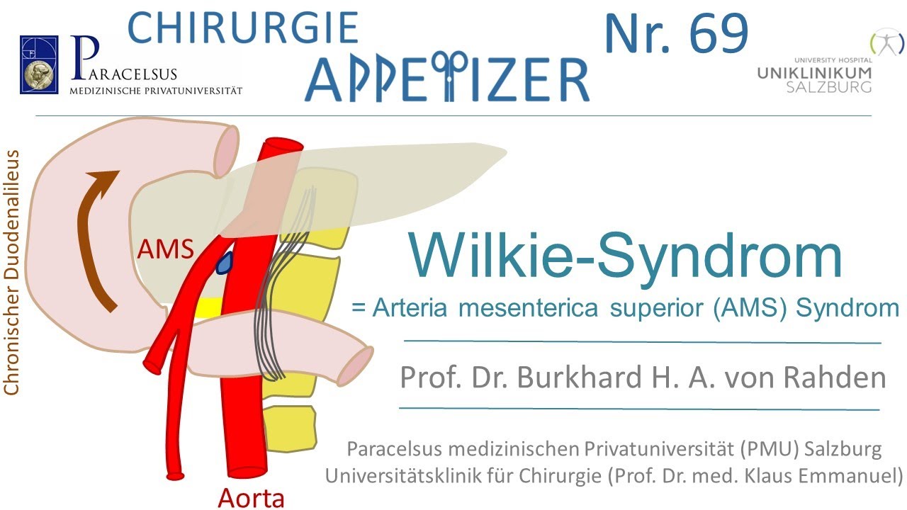 Wilkie-Syndrom = Arteria mesenterica superior (AMS) Syndrom CHIRURGIE APPetizer Nr. 69