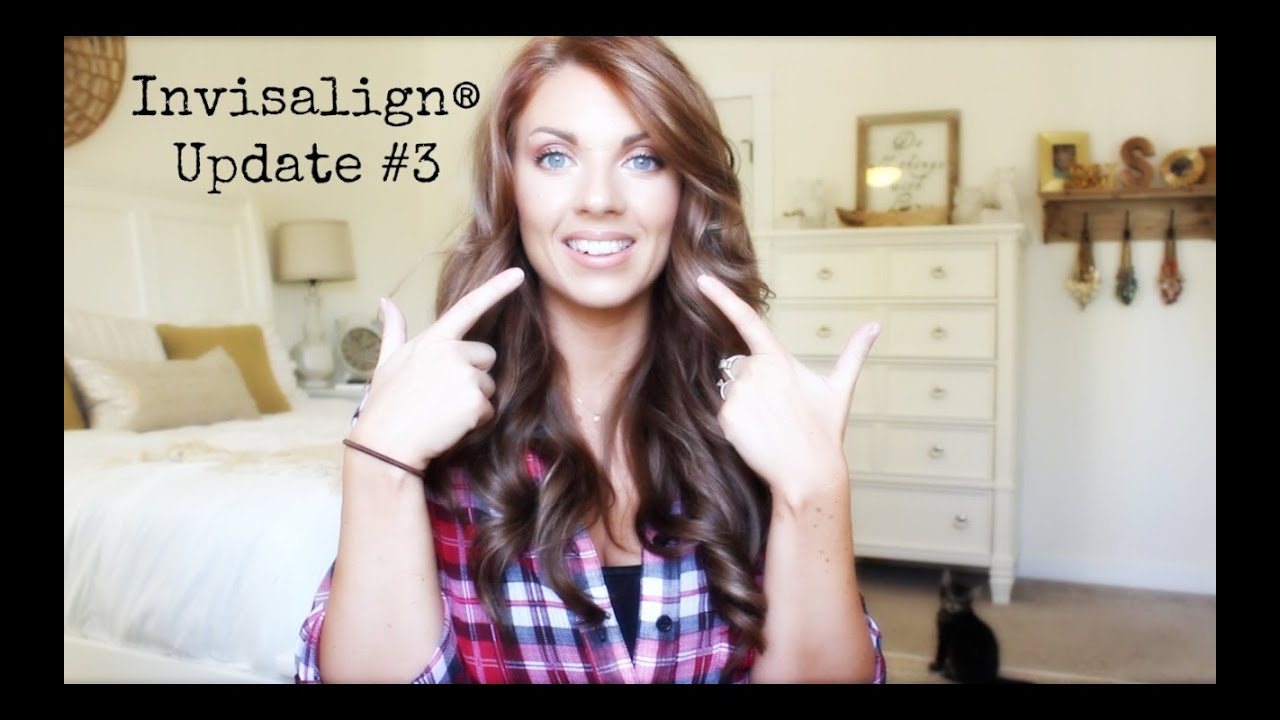 ❤ Invisalign® Update #3 ❤