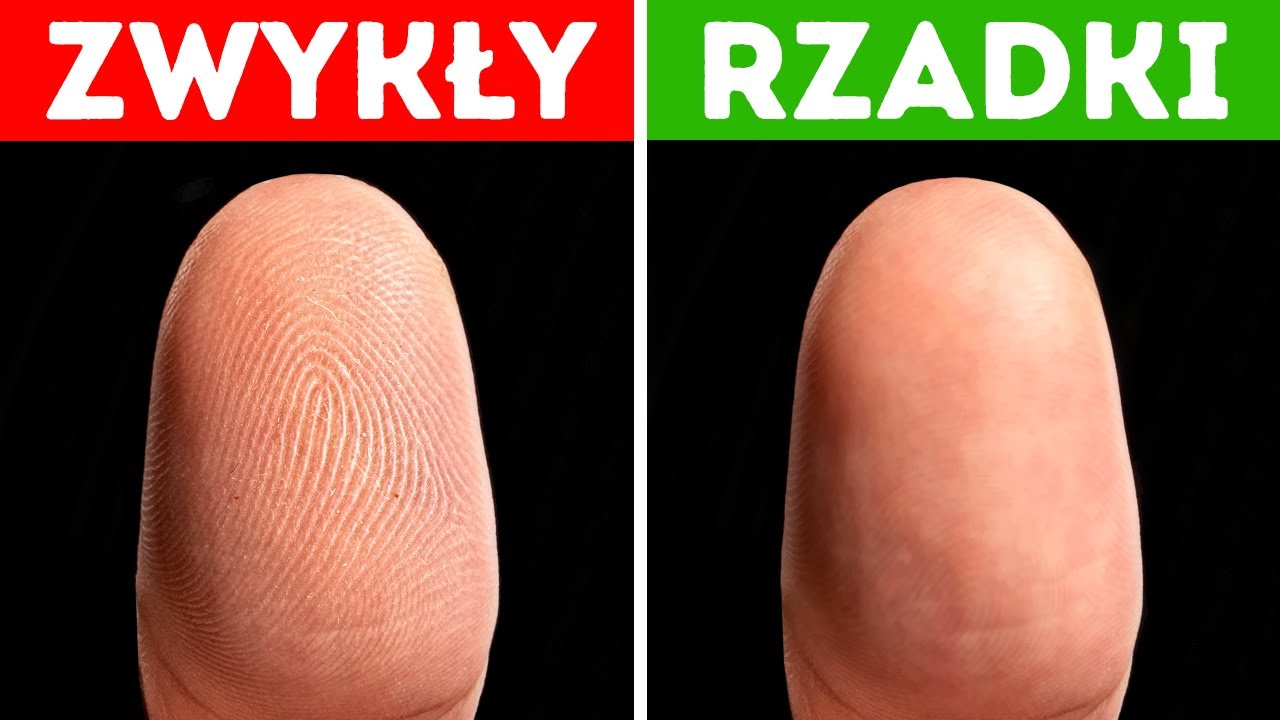 Jak żyją ludzie bez odcisków palców i inne ciekawostki ze świata