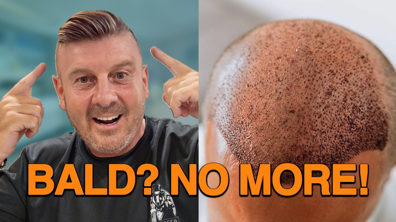 I'm having a HAIR TRANSPLANT in Pattaya? No more bald Webby!