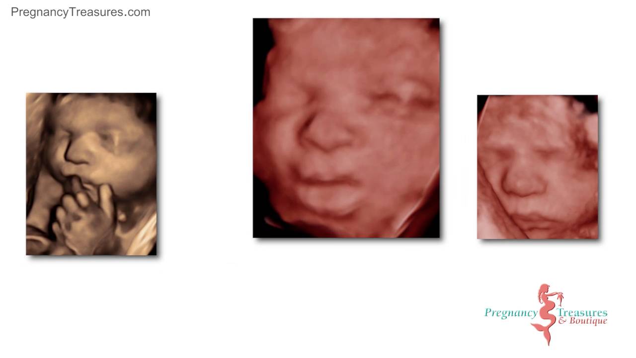 32 week 3D/4D and High Definition Ultrasound Scan of the week