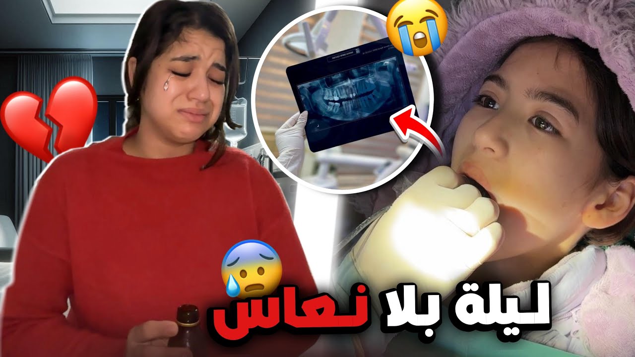 شنو وقع عند طبيب⁉️🥺نور تعذبات💔دوزنا ليلة كاملة بلا نعاس🦷وجع الضرس طيّحنا فالعذاب🤦🏻‍♀️