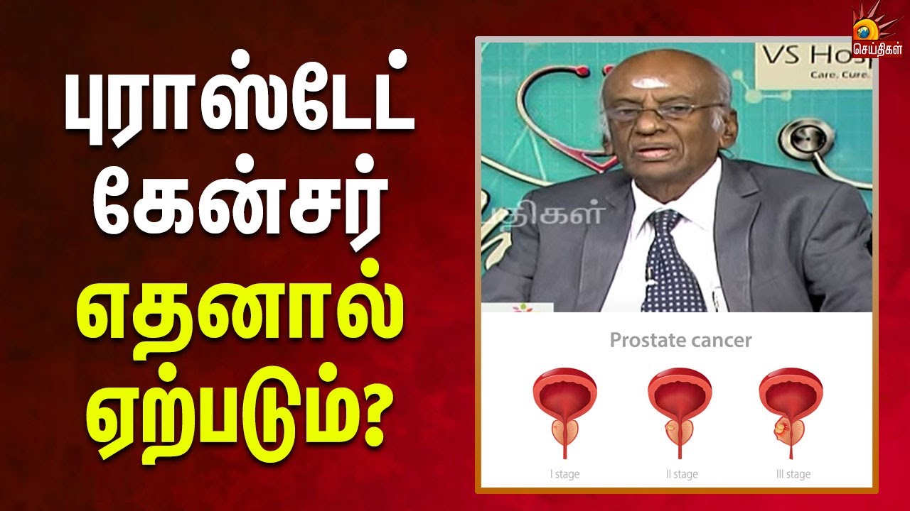 Prostate cancer-க்கான அதிநவீன சிகிச்சைகள் என்னென்ன? | Check Up | VS Hospitals