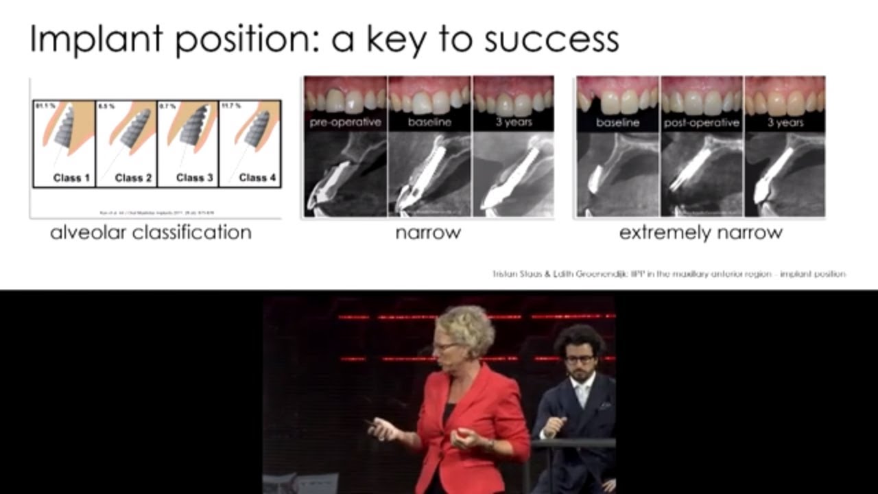 The influence of implant position on short- and long-term outcomes.
