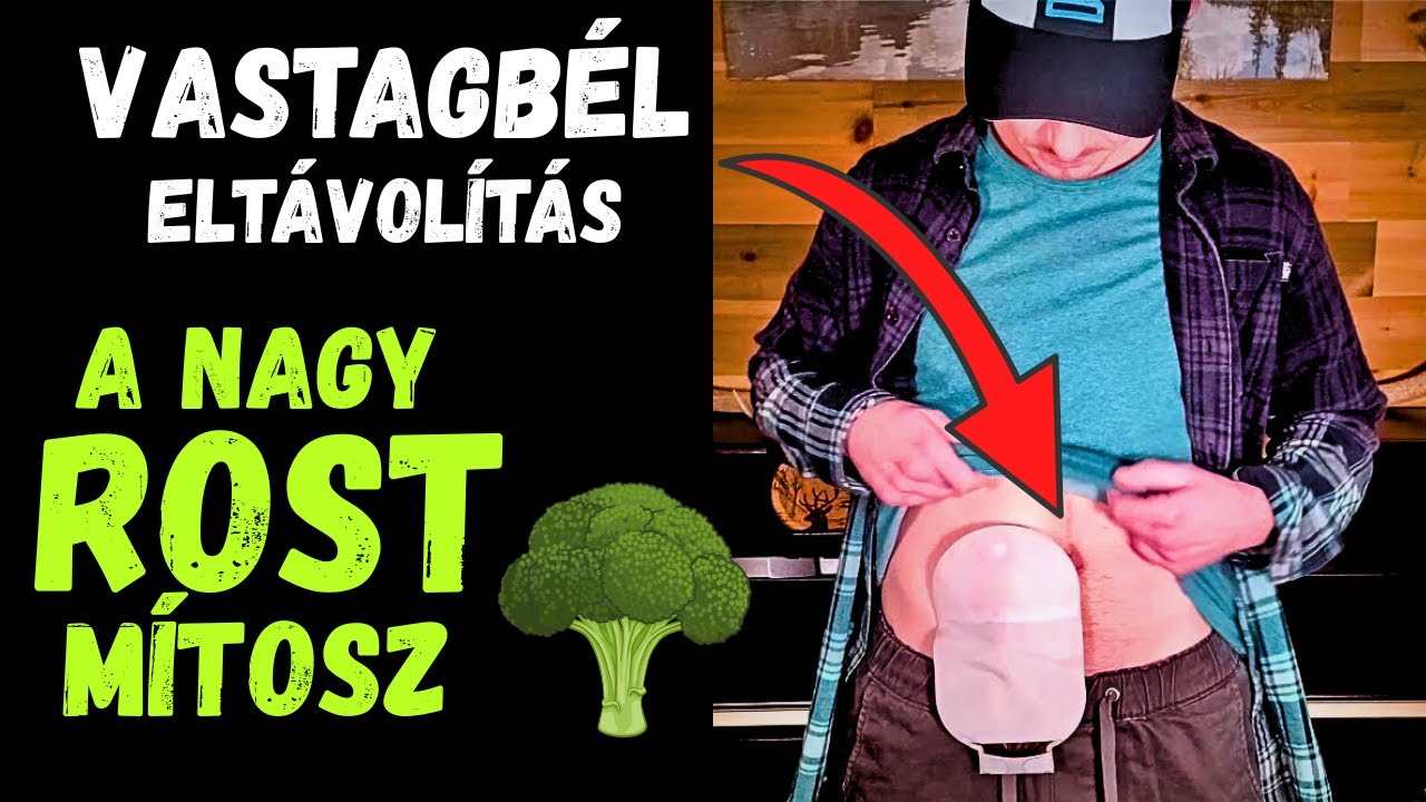 Rost: T&eacute;nyleg ennyire hasznos? 