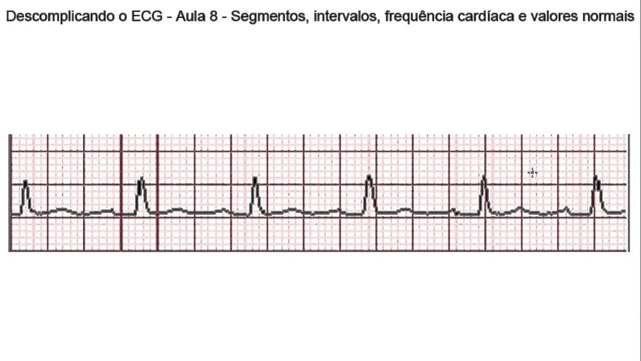 Descomplicando o ECG - Aula 8 - Segmentos, intervalos, frequência cardíaca e valores normais