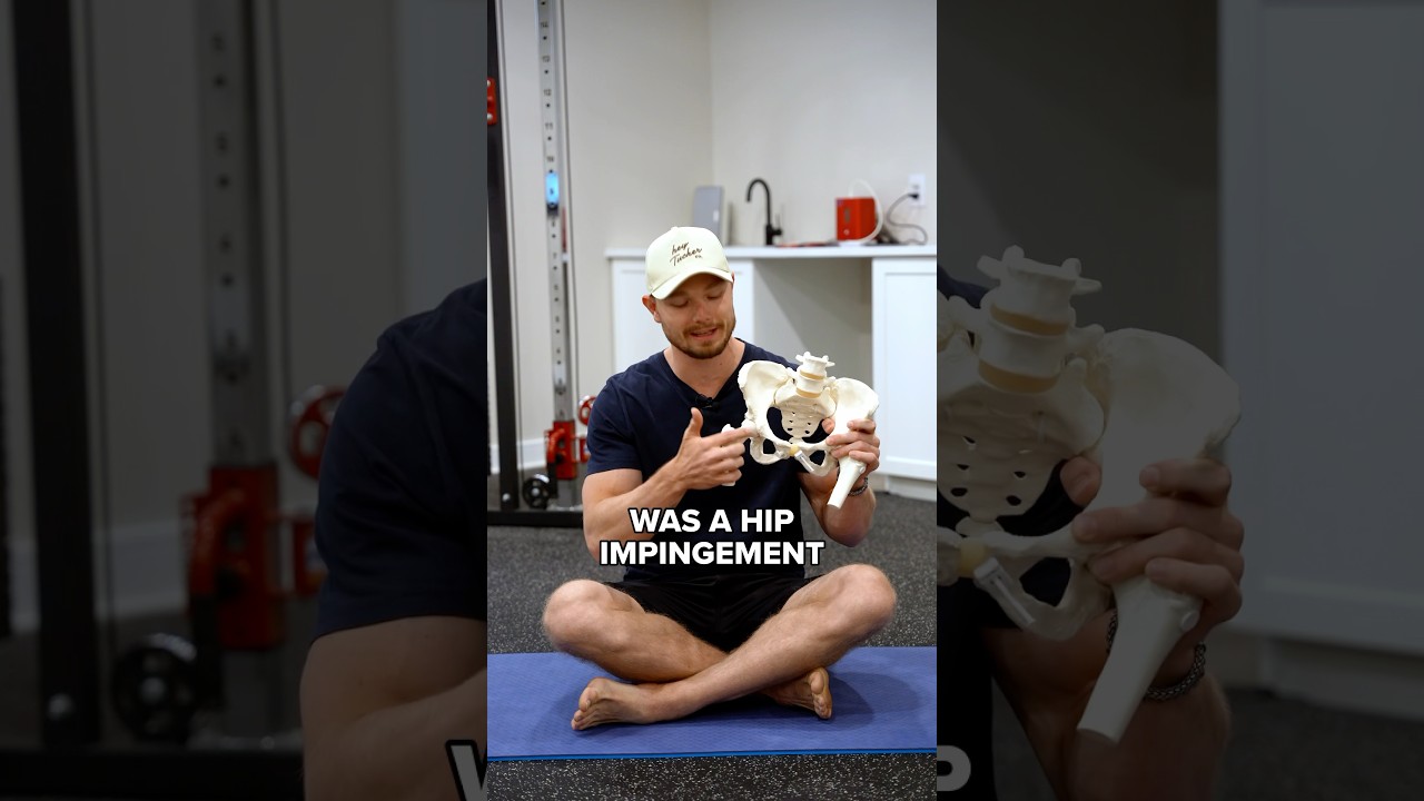 Fix Hip Impingement Fast with One Exercise