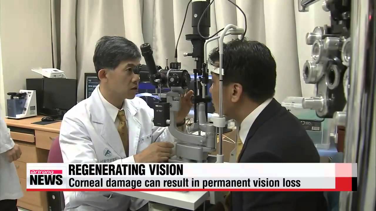 U.S. researchers succeed in repairing corneas using dental stem cells   사랑니 줄기세포