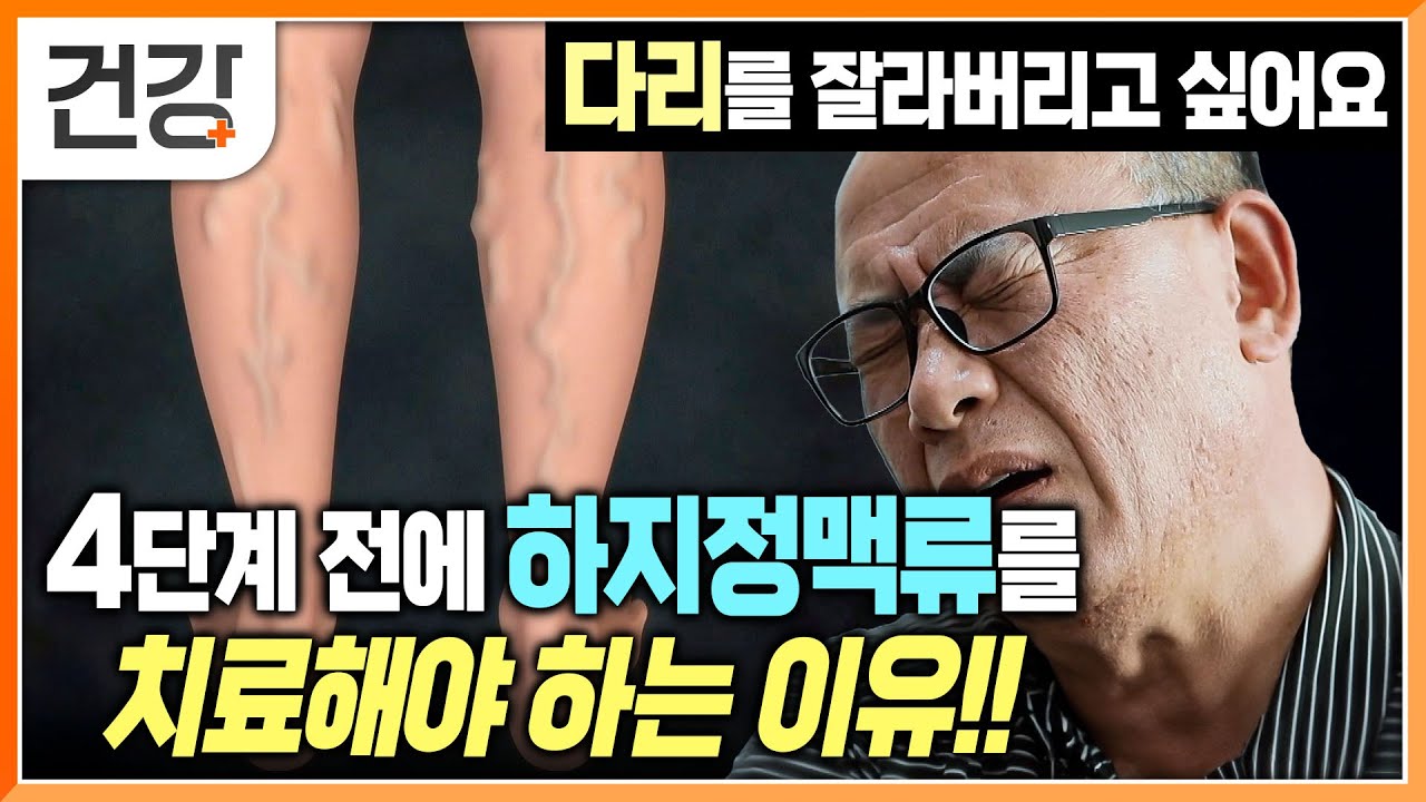 잠을 이룰 수 없는 고통! | 밤 마다 찾아오는 근육 경련 | 하지정맥류 증상과 치료법 | 혈액 순환 | 귀하신 몸