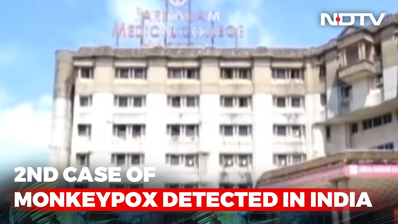 India's Second Monkeypox Case In Kerala's Kannur, Man Travelled From Dubai