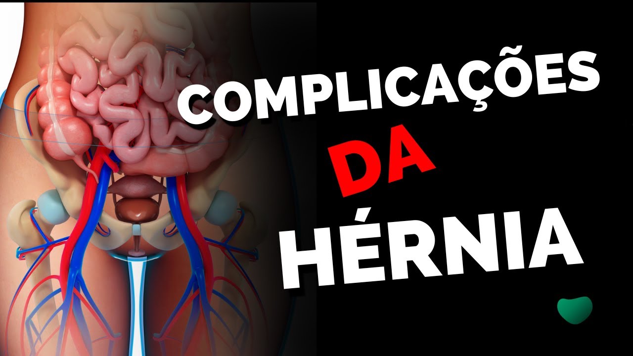 Complicações da CIRURGIA DE HÉRNIA INGUINAL