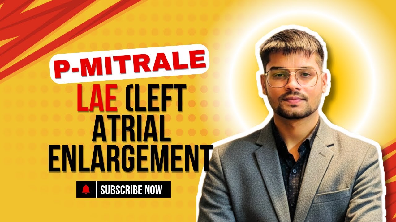 Left Atrial Enlargement (LAE) on ECG | Criteria, Causes & Easy Identification | P-mitral 