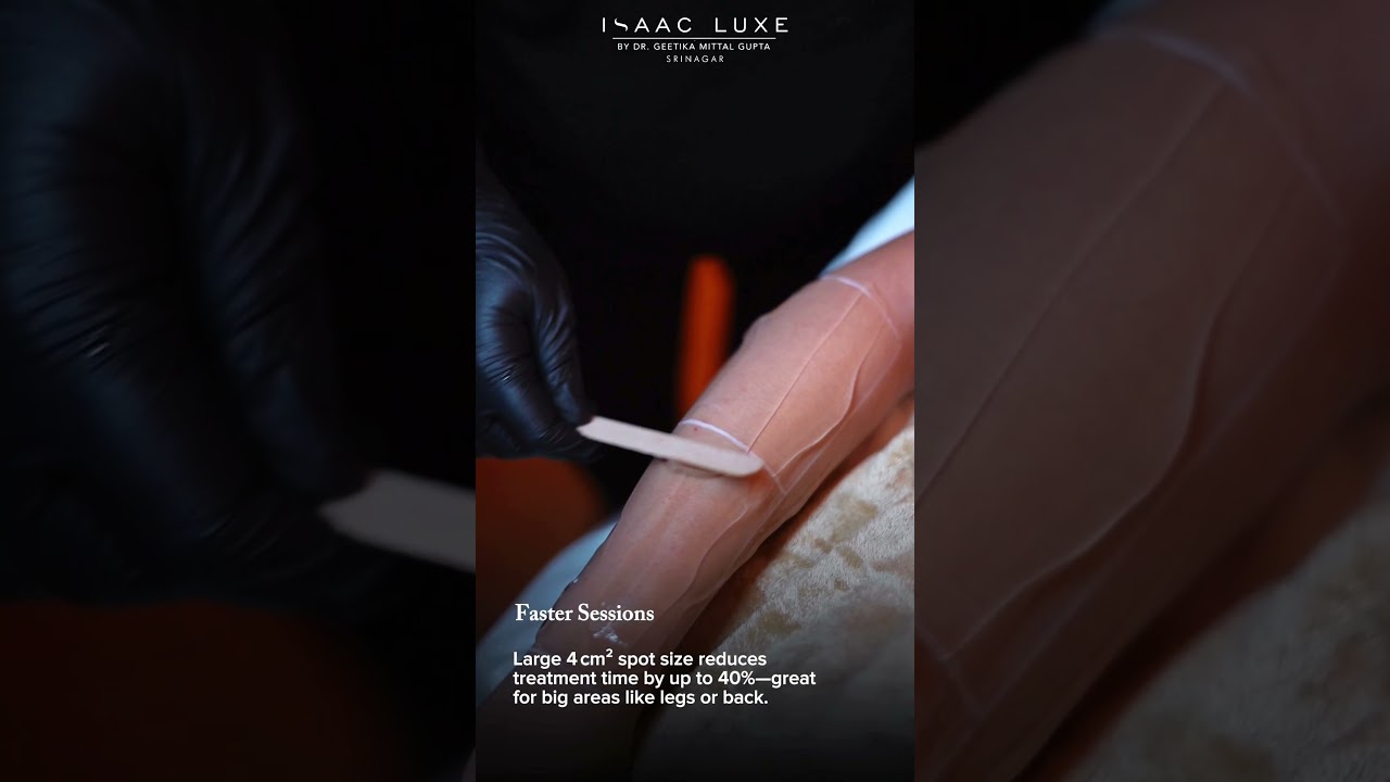 Ditch the wax. Glow with laser! Silky-smooth, pain-free, and permanent &mdash; only at ISAAC Luxe Srinagar