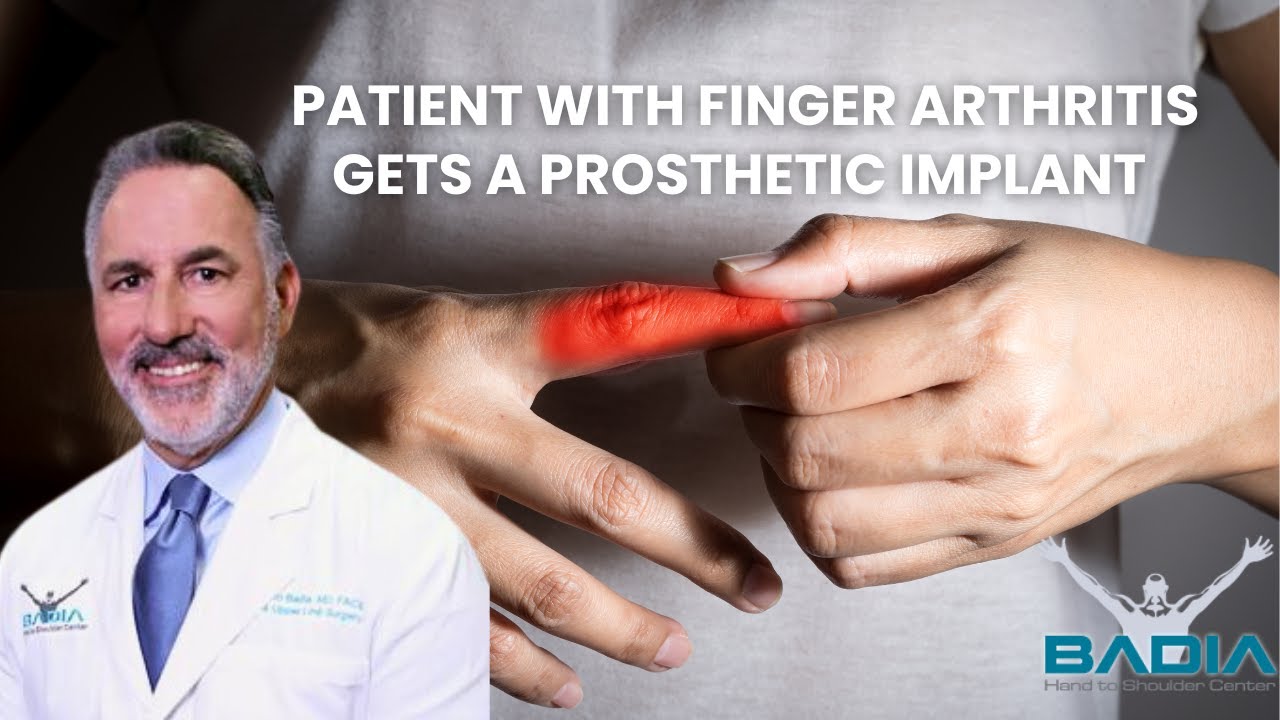 Implant for Finger arthritis - Patient shows motion just 48hrs after surgery!
