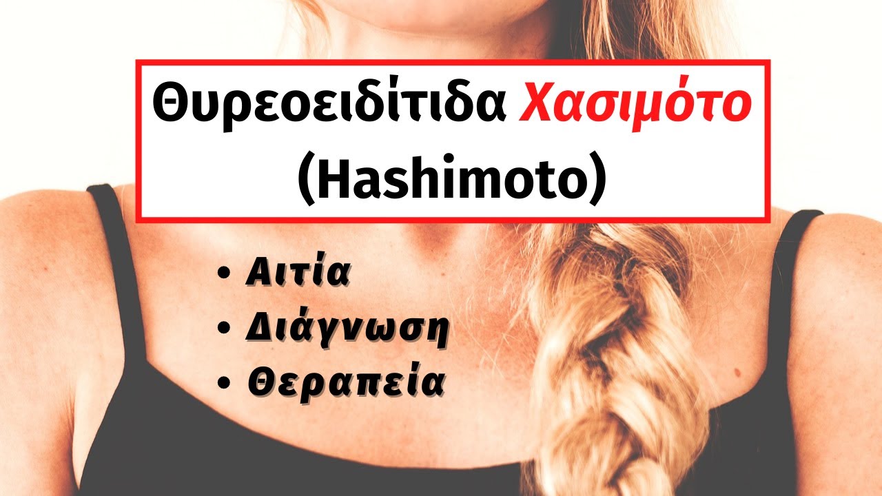 Θυρεοειδίτιδα Χασιμότο: Διάγνωση και θεραπεία