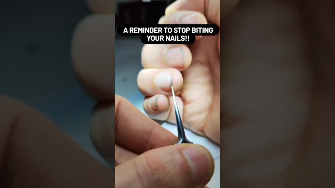 Dirty nails under the microscope | Nails Germs under microscope | Nails Germs 😱#shorts #microscope