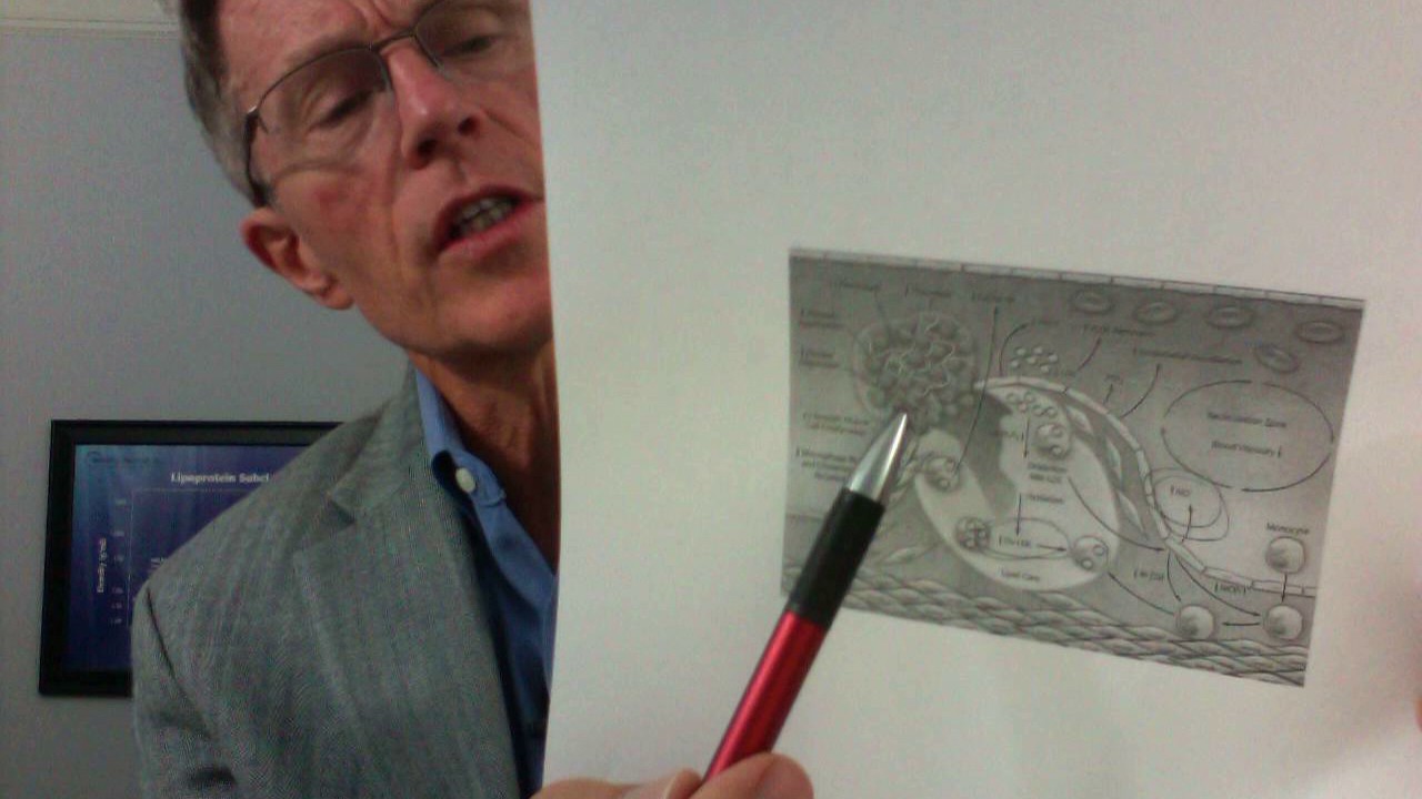 Cellular View - Cardiovascular Inflammation - How Your Immune System Causes Heart Attack/Stroke