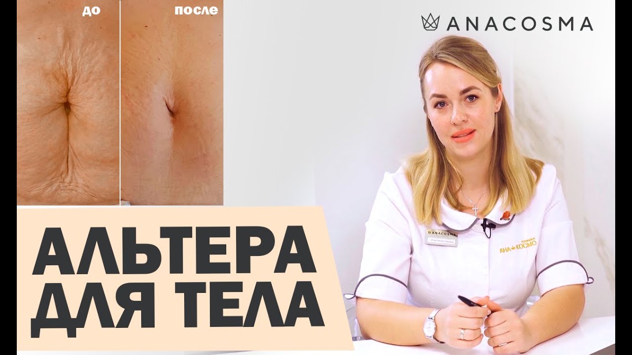 СМАС лифтинг Альтера для ТЕЛА 🔥 Убрать дряблый живот, руки, колени