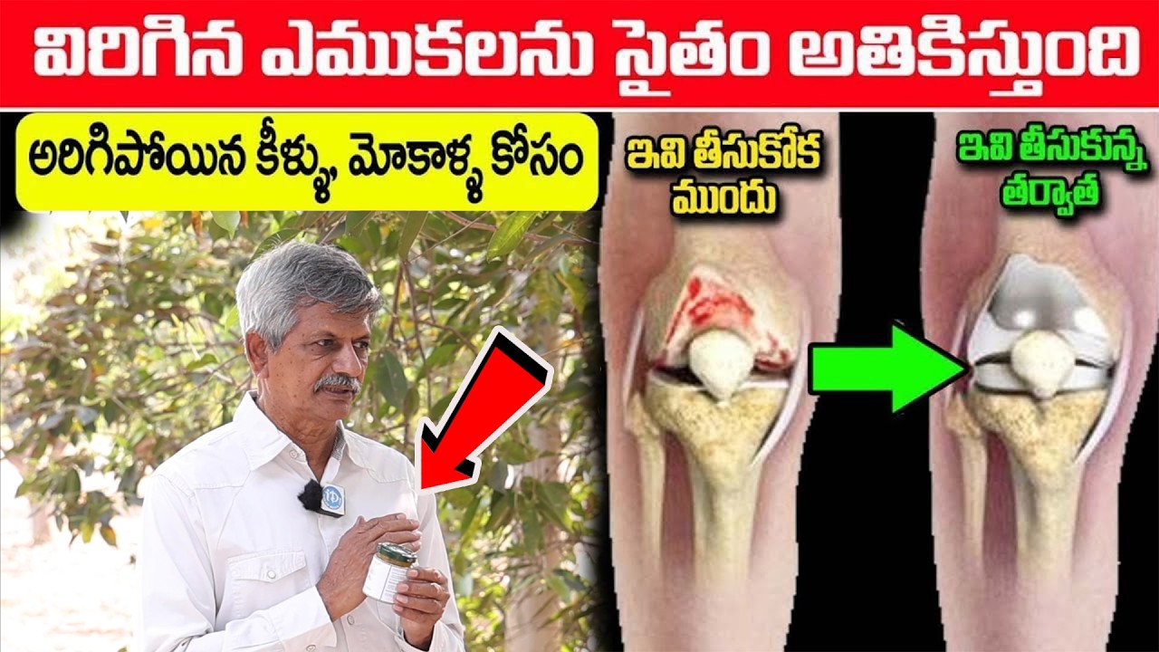 100% EFFECTIVE మోకాళ్ళ నొప్పులు పోయి తొక్కుడు బిళ్ల ఆడేస్తారు || knee Pain Cure || Dr. Anjaneyaraju