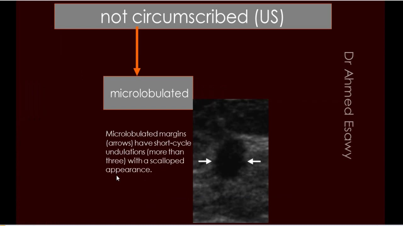 1 sonomammography ACR BIRAD breast mass description