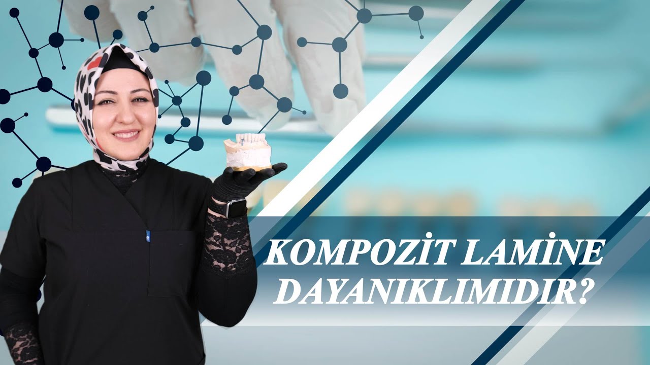 KOMPOZİT LAMİNE DAYANIKLIMIDIR?