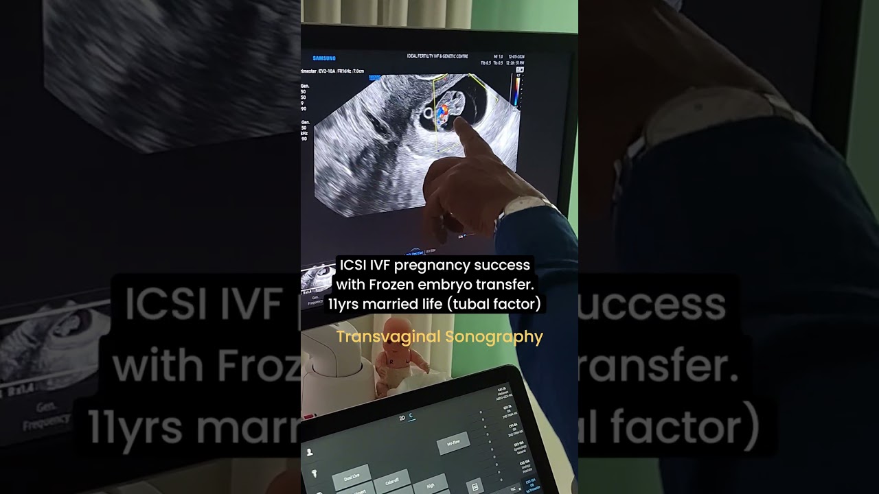#ivfbaby #transvaginalsonography #ivfcenter #infertilitytreatment