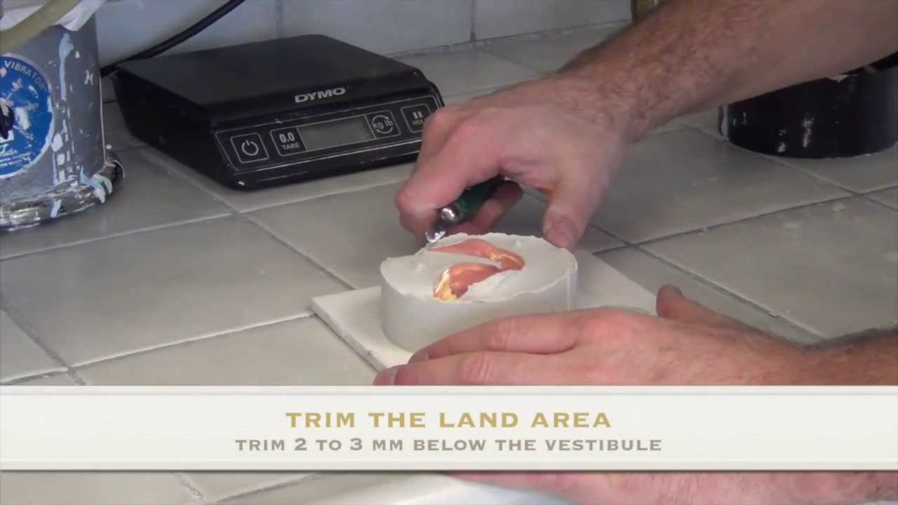 How to Base and Pour an Edentulous Mandible Final Impression
