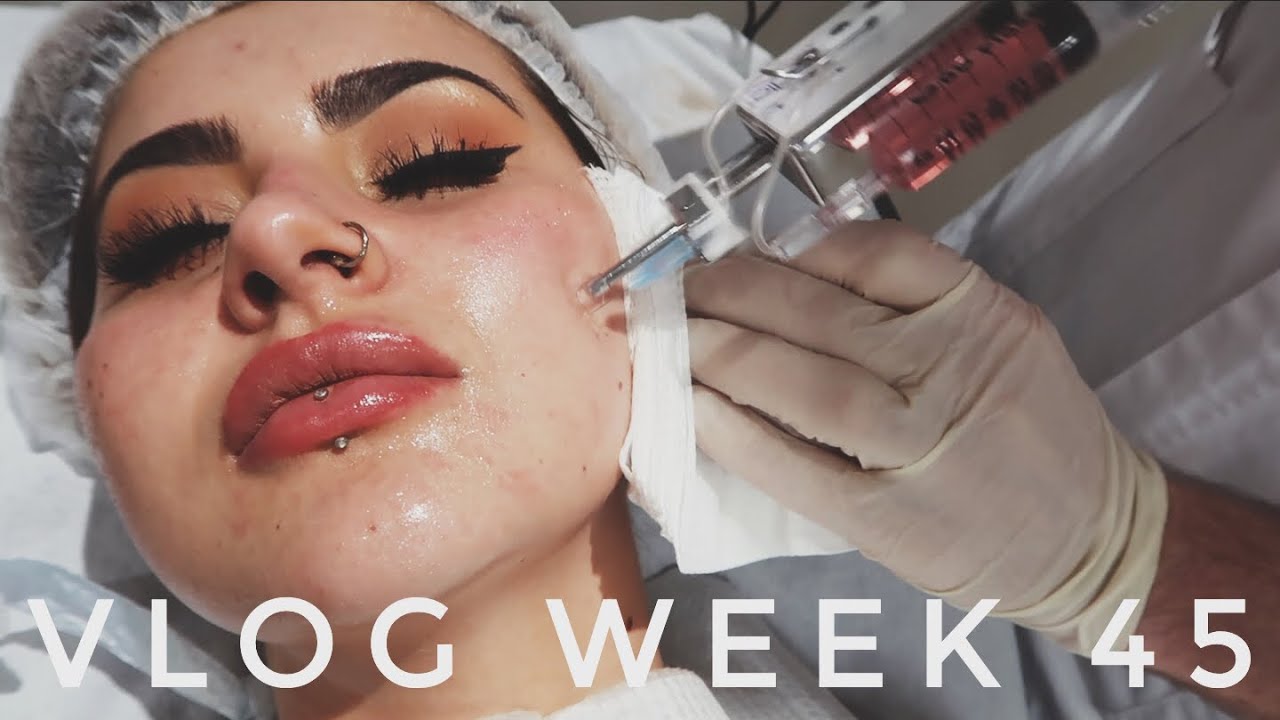 VLOG WEEK 45 - THE BEST FACIAL & MY DOGS BIRTHDAY | JAMIE GENEVIEVE