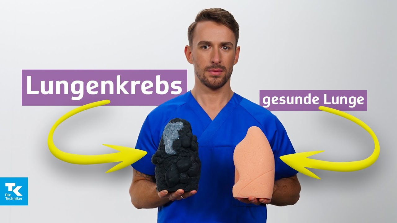 Lungenkrebs verstehen: Ursachen, Symptome, Diagnose & Therapie | DocTommy