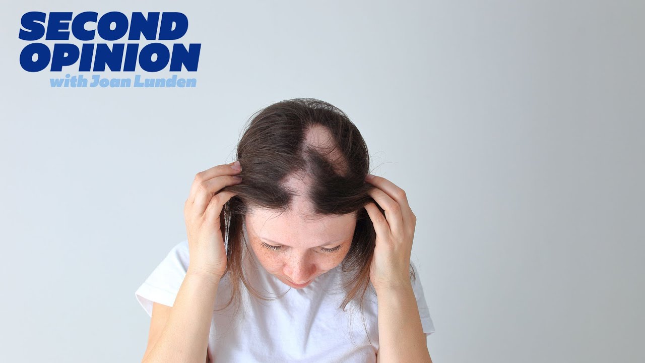 WHAT IS ALOPECIA AREATA? | SECOND OPINION WITH JOAN LUNDEN |