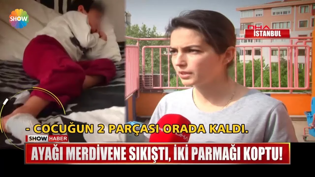 Ayağı merdivene sıkıştı, iki parmağı koptu!