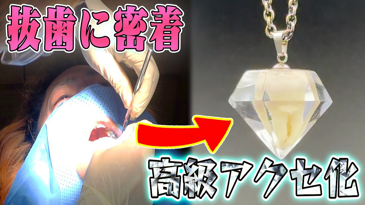【大抜歯】親知らずを抜いたので完全手作りで『世界に一つのネックレス』にしてみたい！！！