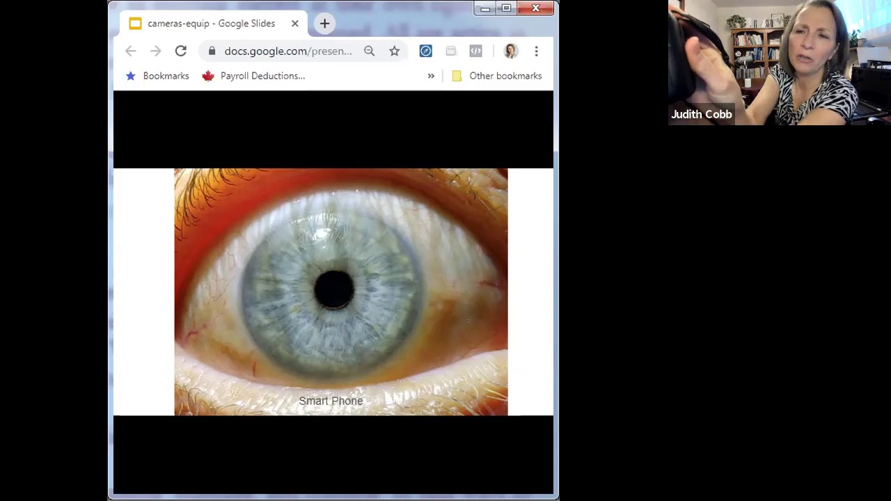 Iridology Cameras and Equipment