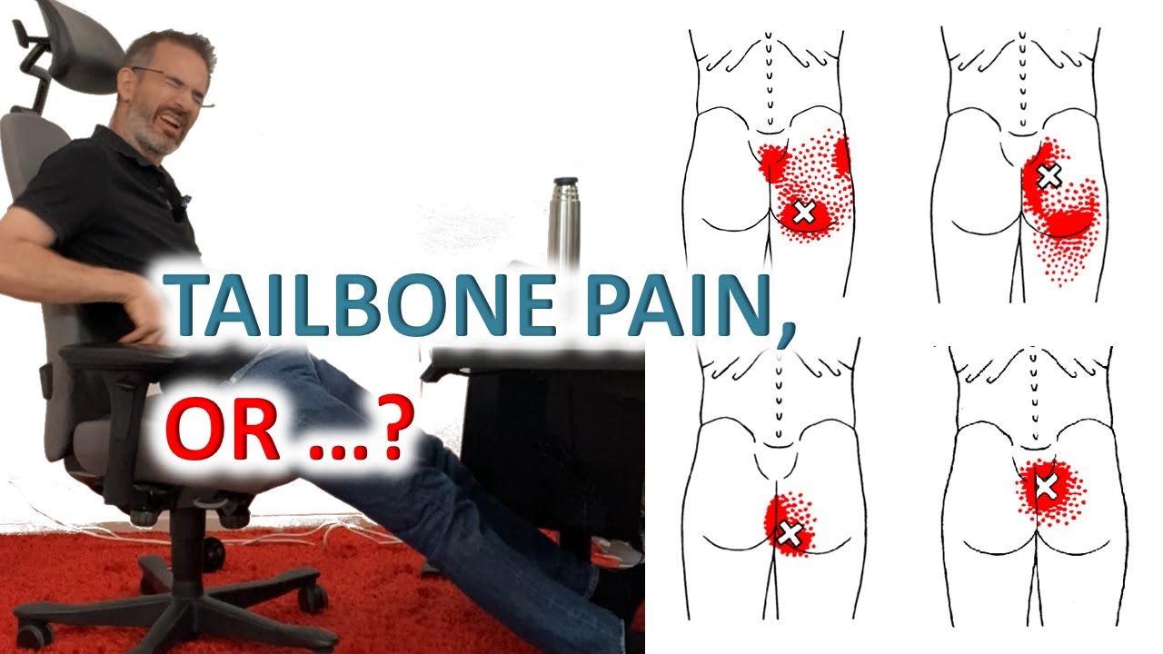 Your Sitting Posture Can Cause Tailbone Pain - Gluteus And Multifidi Muscles