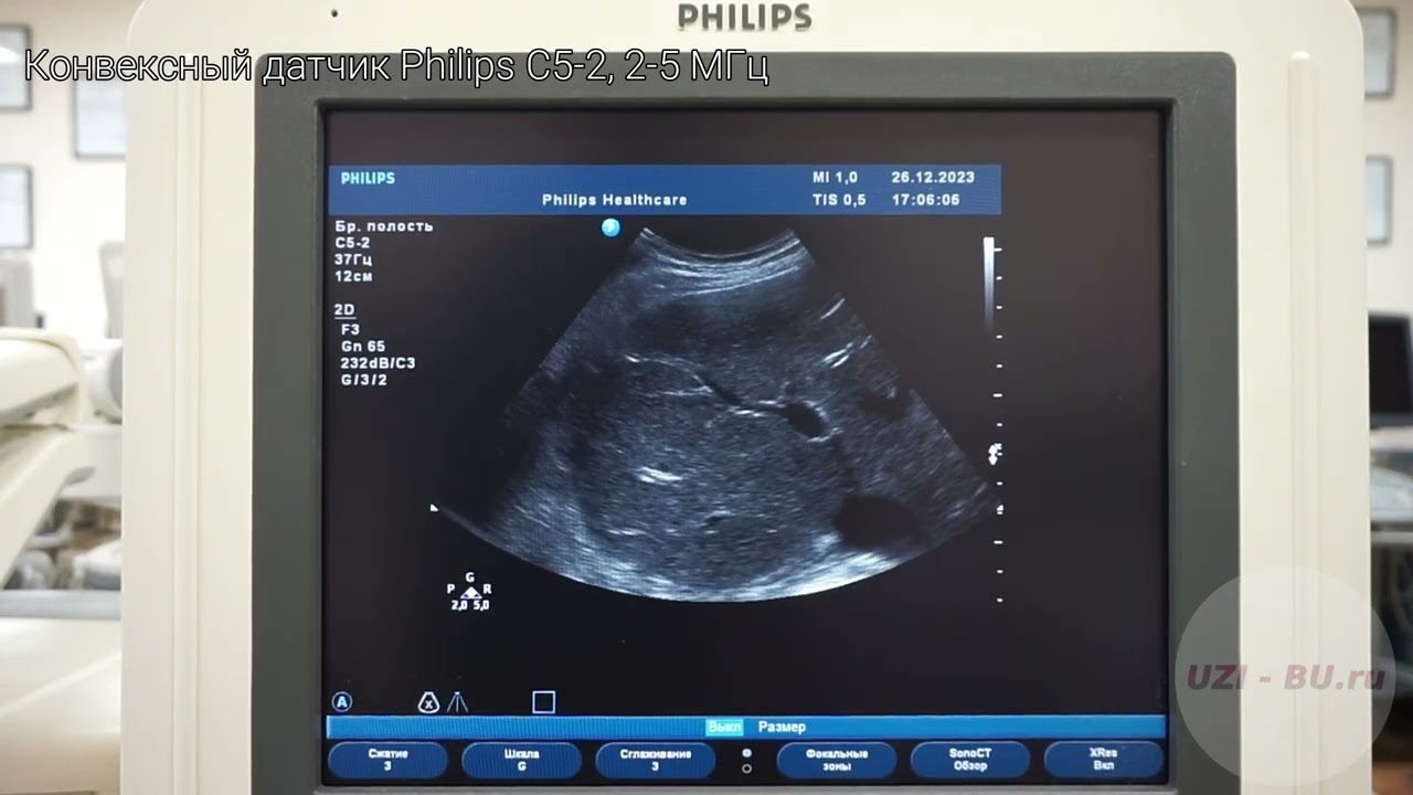 Philips HD11 XE обзор ультразвукового сканера