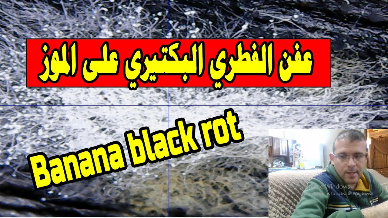 العفن الفطري البكتيري على الموز  التعفن الأسود للموز- Bacterial mildew on bananas   Banana black rot